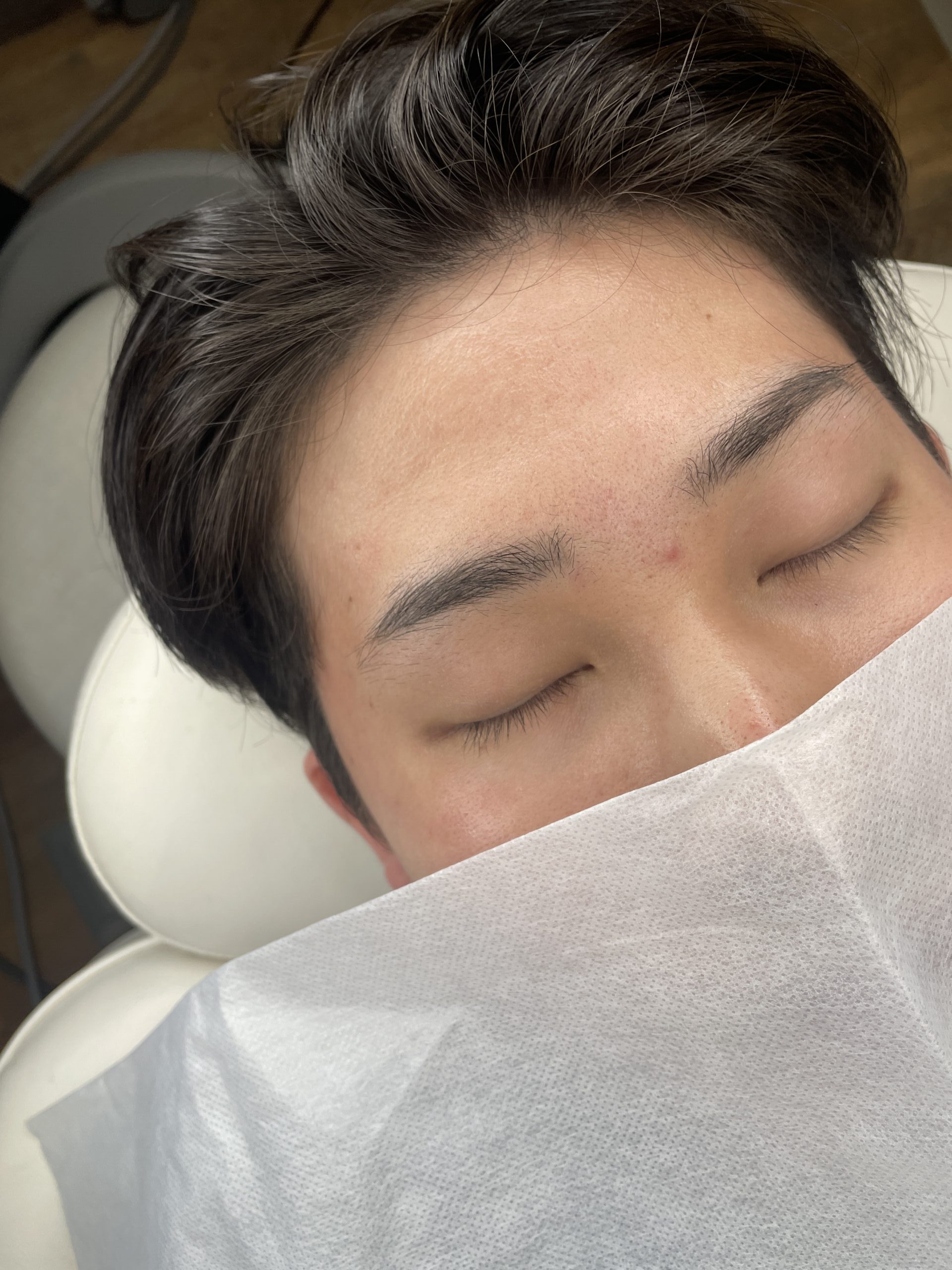 AFTER